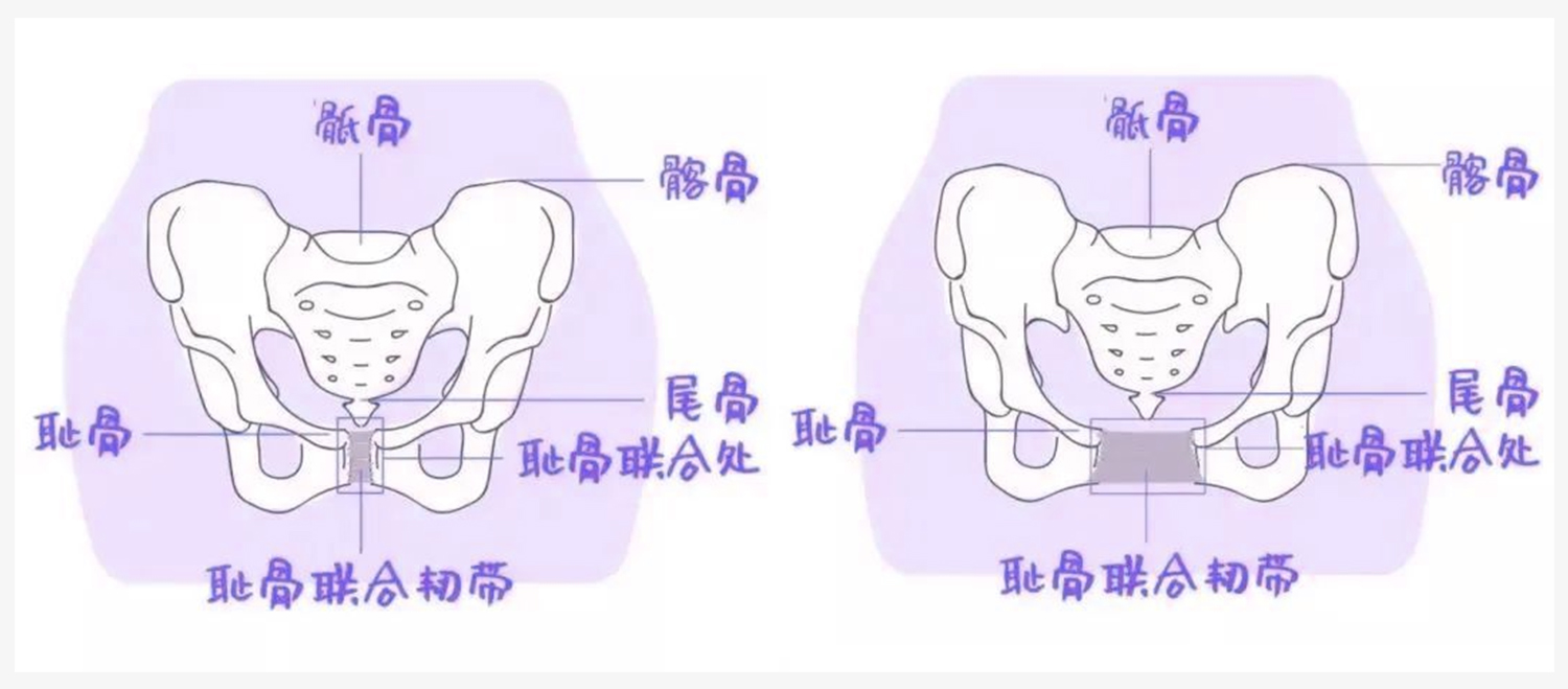 推荐-骨盆底 (2)